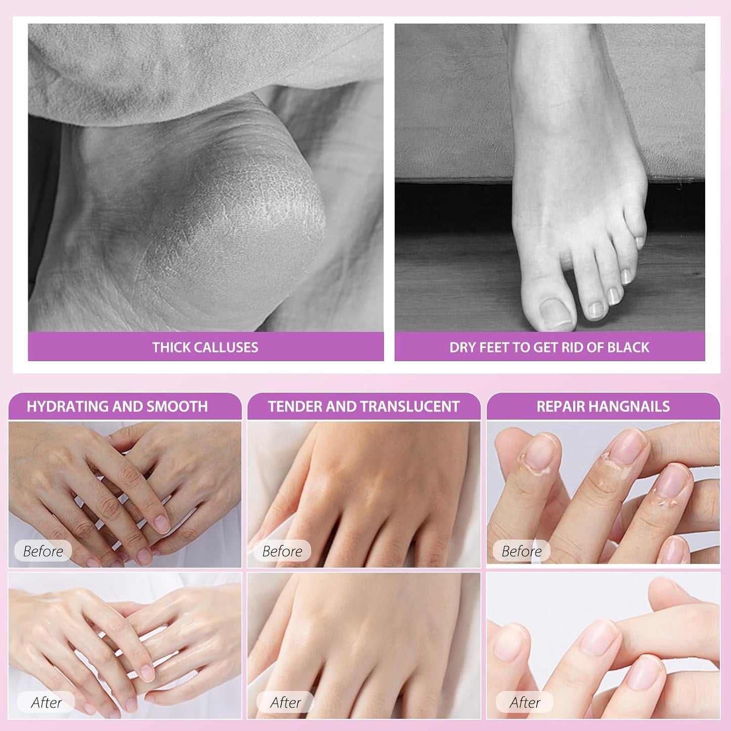 Hydrating Hand Foot Masks Set,5 Pack Glove Mask for Dry Hand,Exofliating 5 Pack Socks Maskfor Peeling Away Dead Skin Calluses(Lavender)