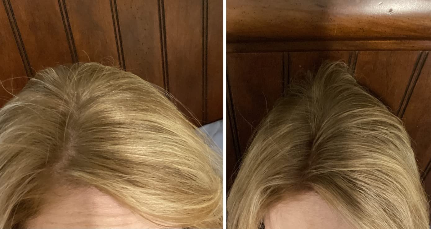 Caboki Hair Loss Concealer. All-Natural, Plant-Based Hair Building Fiber. Covers Bald Spot and Thinning Hair. Makes Thin Hair Look 10X Fuller Instantly (30G, 90-Day Supply). Natural Blonde