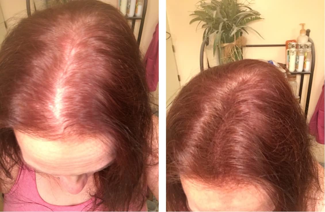 Caboki Hair Loss Concealer. All-Natural, Plant-Based Hair Building Fiber. Covers Bald Spot and Thinning Hair. Make Thin Hair Look 10X Fuller Instantly.(30G, 90-Day Supply). Light Auburn