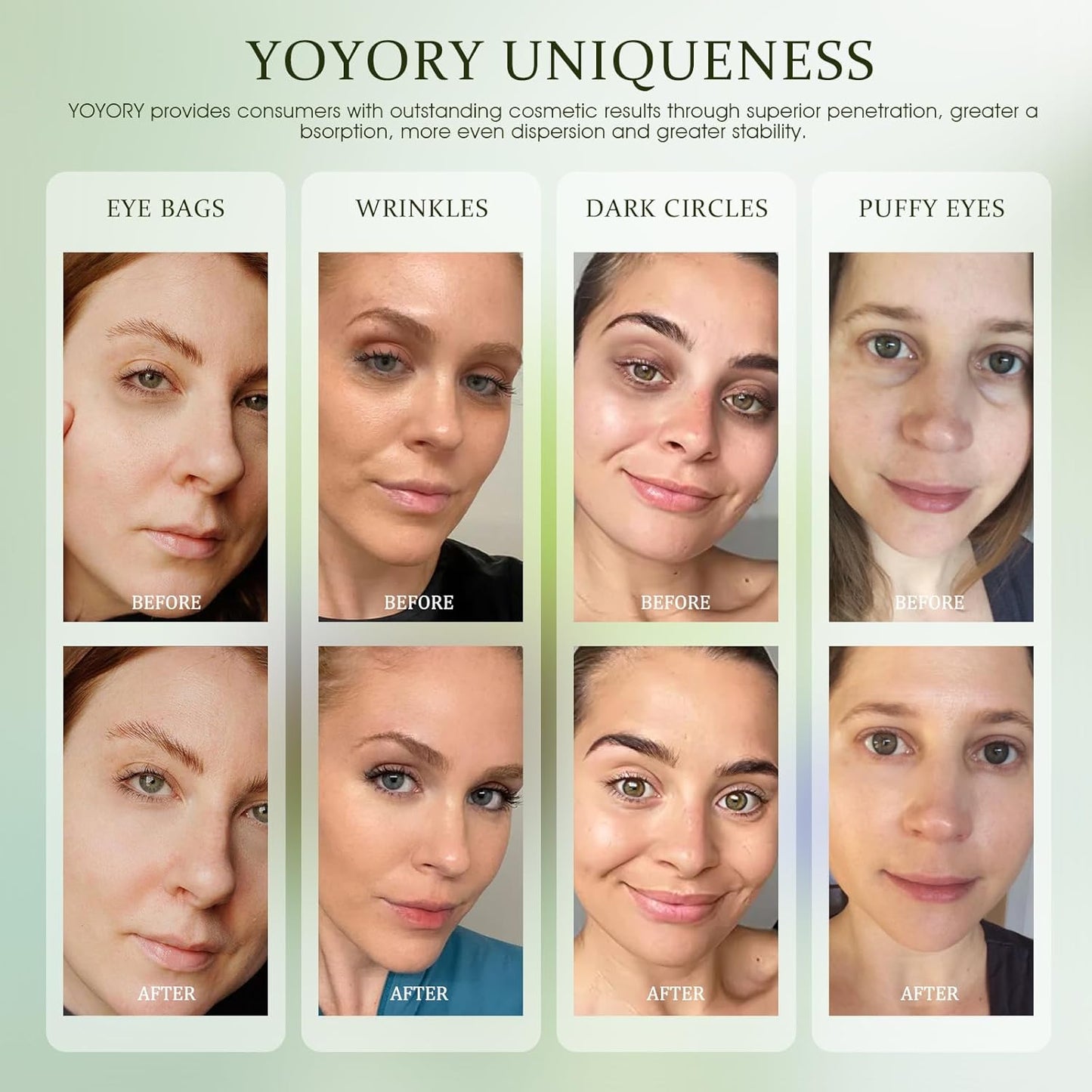Under Eye Patches Masks - for Eye Bags with Collagen and Hyaluronic Acid, Dark Circles,and Fine Lines, Fade Wrinkles Treatment for Women and Men - 60 Pcs Green