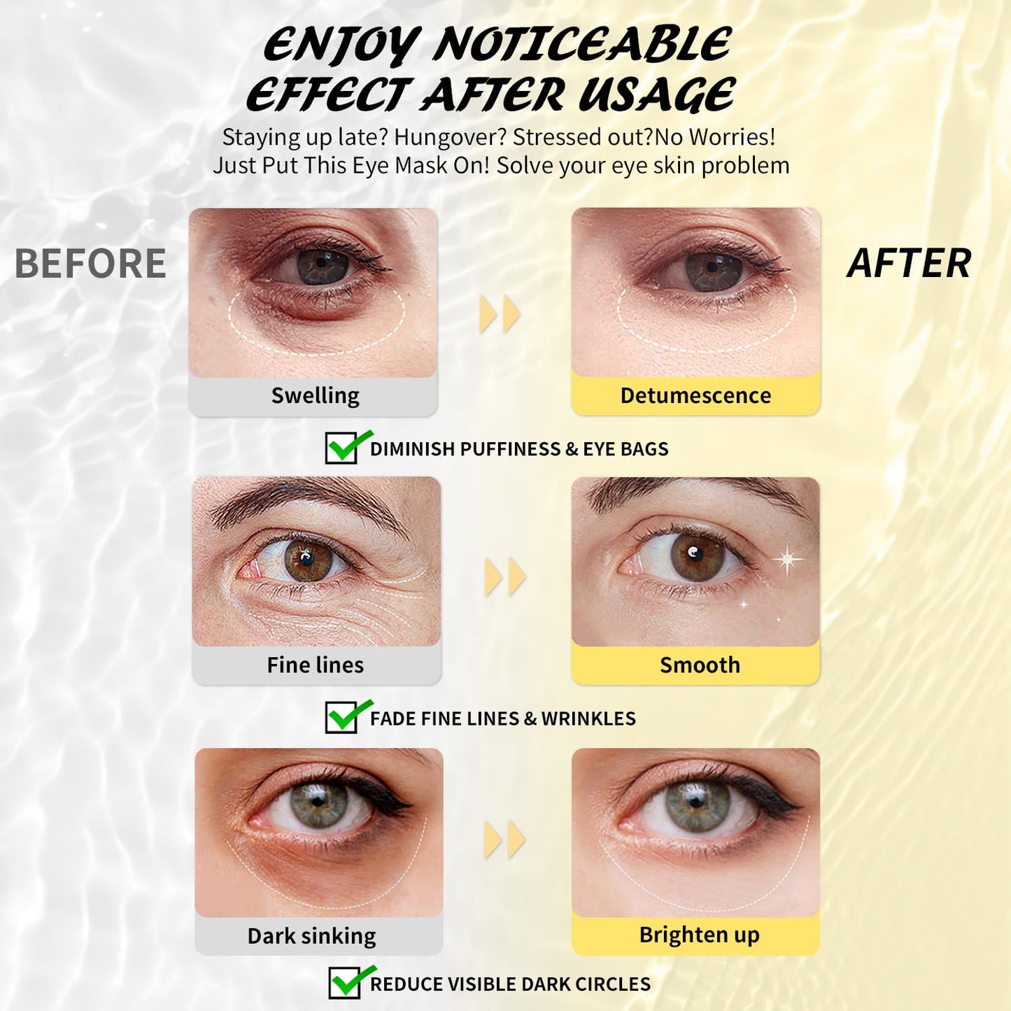 Under Eye Patches (8 Pairs), Caffeine Eye Masks for Dark Circles Puffy Eyes Undereye Bags, Collagen Eye Patches for Wrinkles and Puffiness, Skin Care Gift for Her