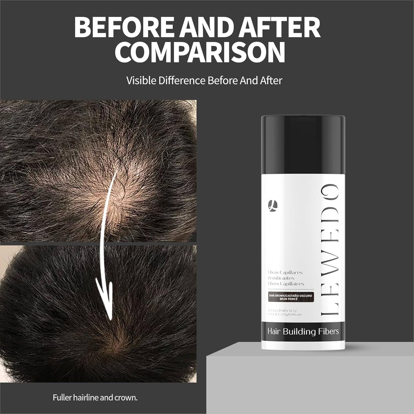 Hair Building Fibers 25G with Precision Spray Applicator - Electrostatic Adsorption for Instant Thicker Hair, Waterproof & Natural Look, Suitable for Men & Women (Light brown)