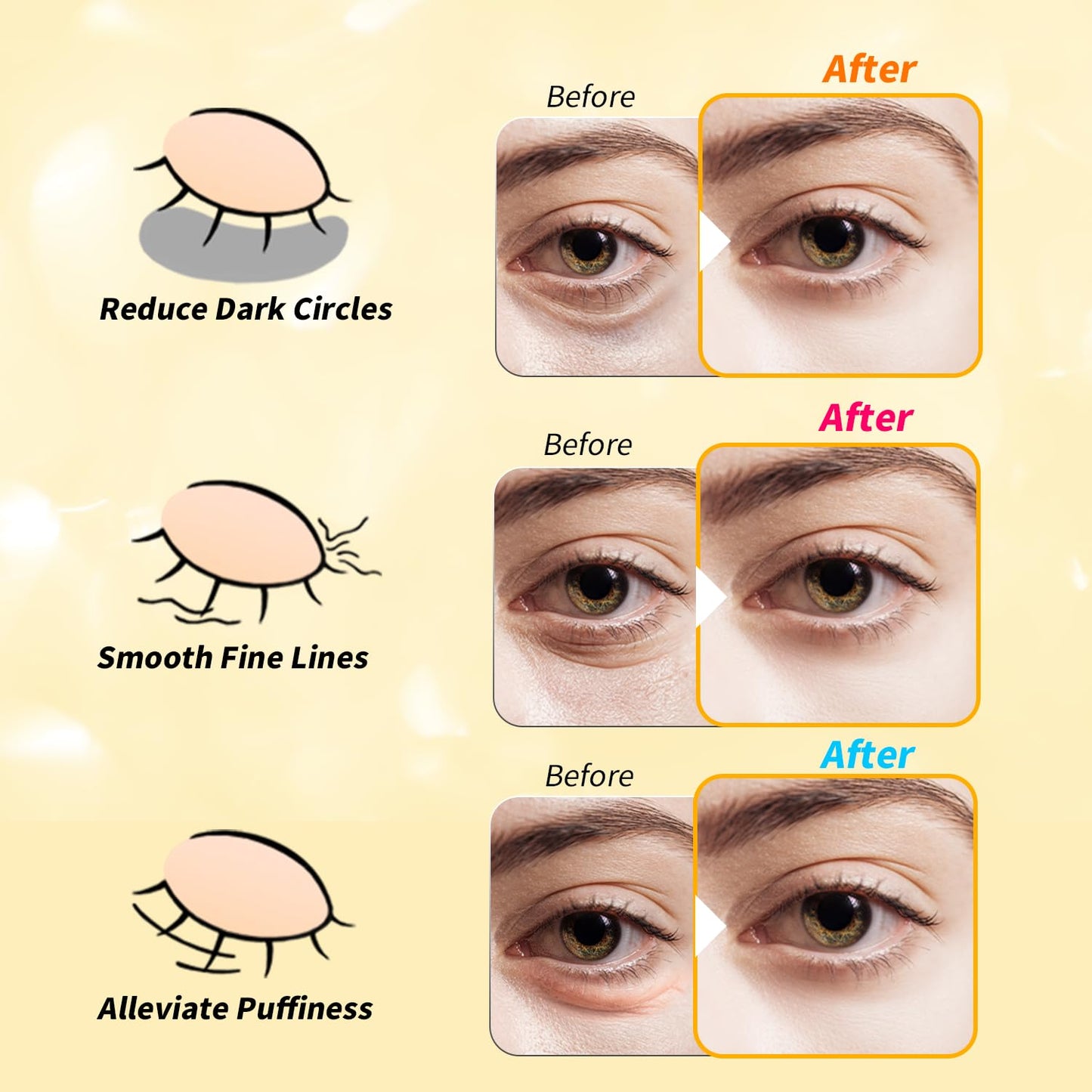 Under Eye Patches(12 Pairs), 24K Gold, Caffeine, Retinol Eye Masks for Puffy Eyes, Wrinkles, Dark Circles, Undereye Bags Treatment - Restoring & Awakening & Moisturizer Skin care Gift for Women