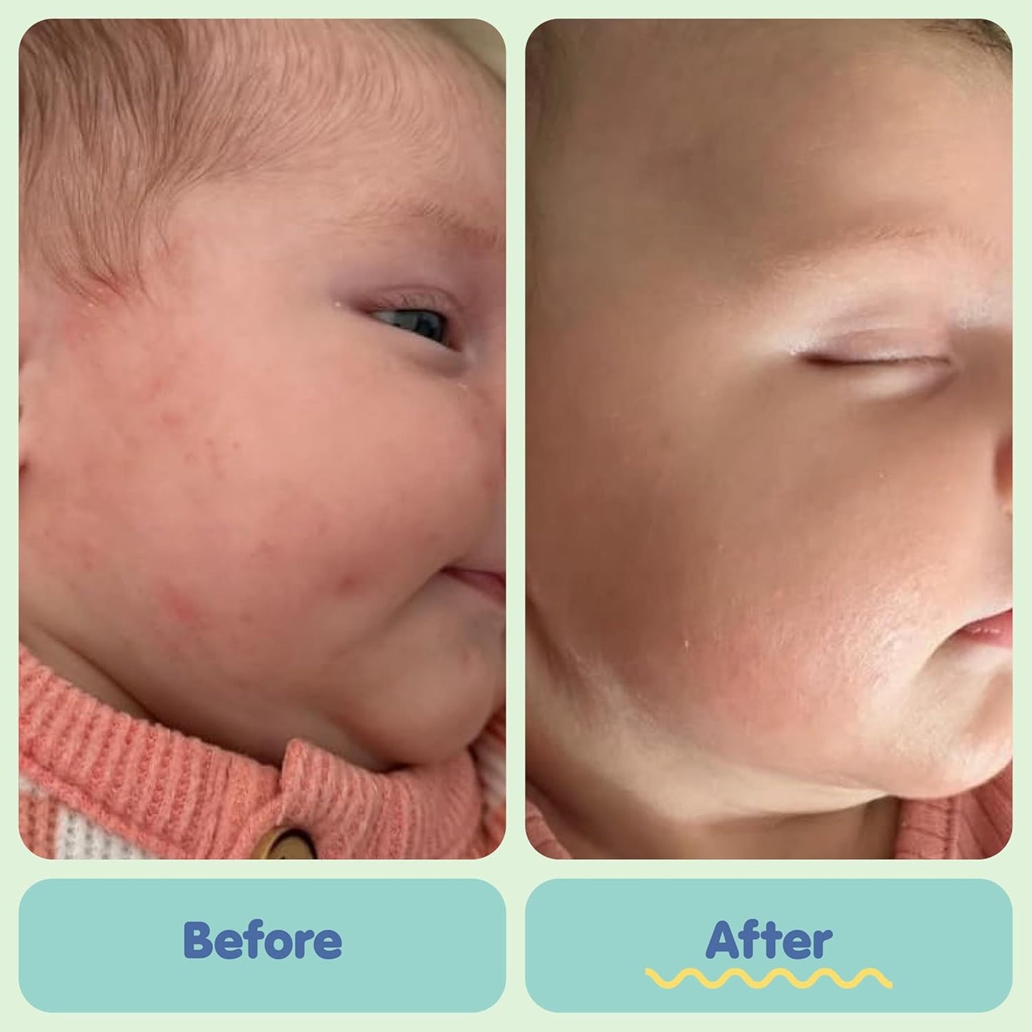 TUBBY TODD All Over Ointment - Baby Eczema Cream, Everyday Multi-Purpose Sensitive, Dry, Irritation Baby Skin Relief Cream, Steroid & Gluten Free, Fragrance Free, 3.5 oz & 8oz, 2 Pack
