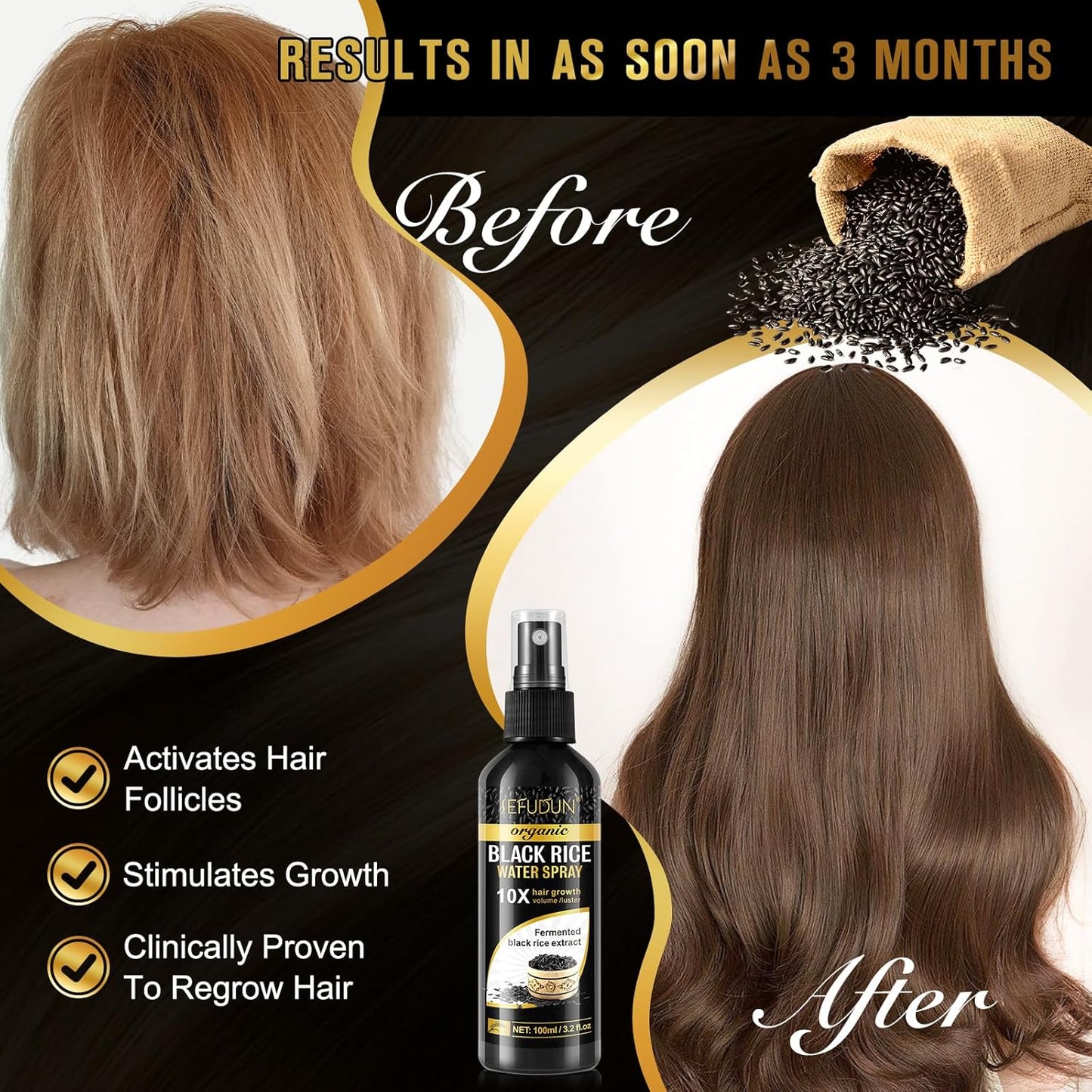 (3Pc) Organic Black Rice Water Spray for Hair Growth, A Solution with Castor Oil & Ginger Root Extract for Thicker, Fuller Hair, Targets Hair Loss and Repairs Damage 300ml/9.6 fl.oz