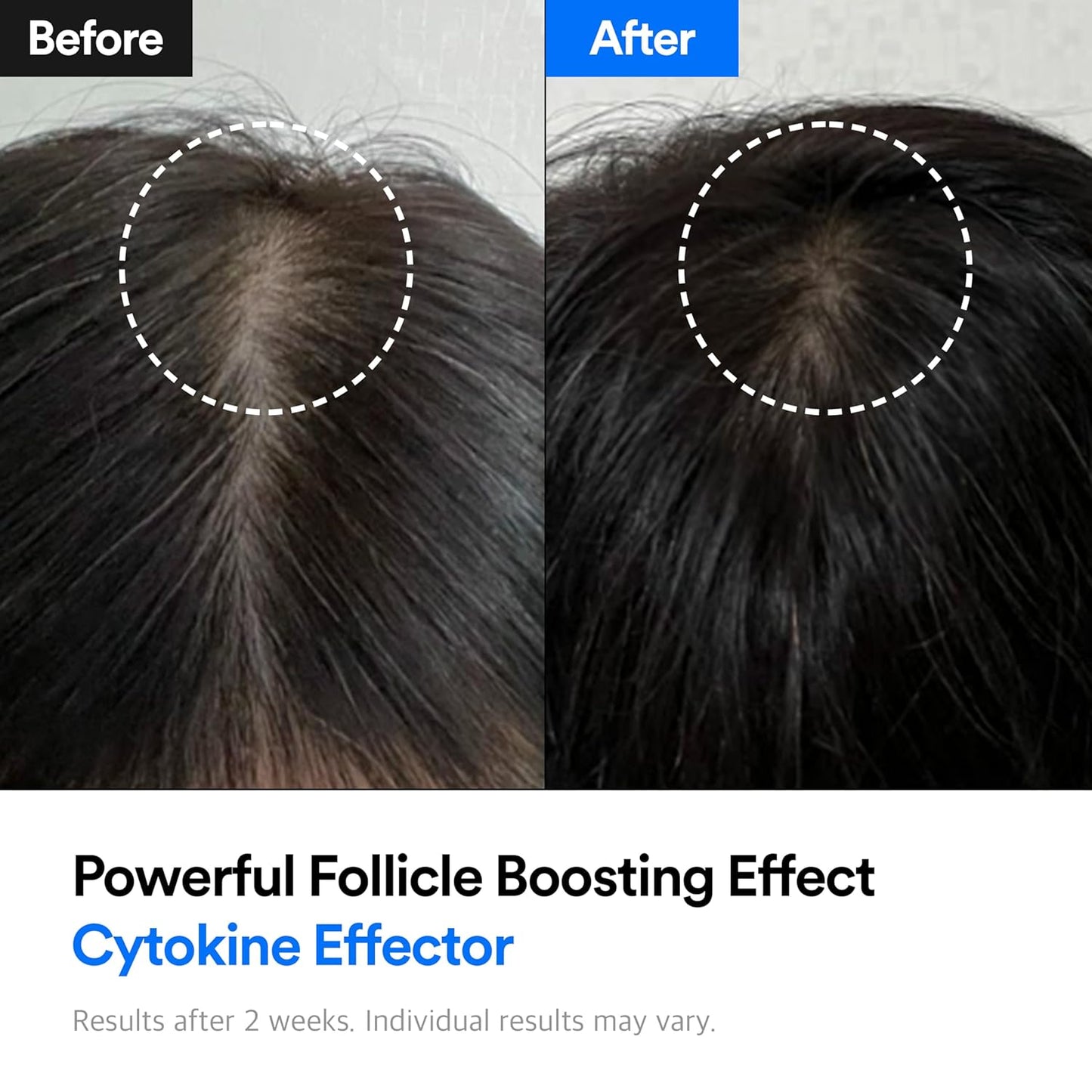 [Refilled] Hair-Recovery Cytokine Effector Plus, 15ml/0.5 Fl. Oz., Clear
