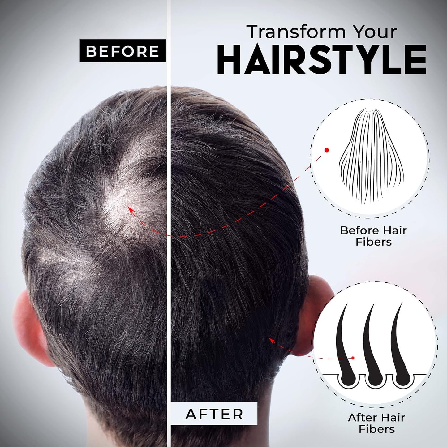 ELEVATE Hair Fibers for Thinning Hair Large Size 40g Bottle - 100% Natural Undetectable Keratin Fibers to Instantly Fill in Thinning Balding Loss Area Fuller in 30 Seconds Men & Women (Black)